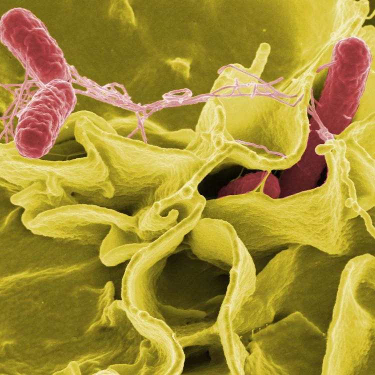 Imagen relacionada de investigacion euskadi brote salmonella