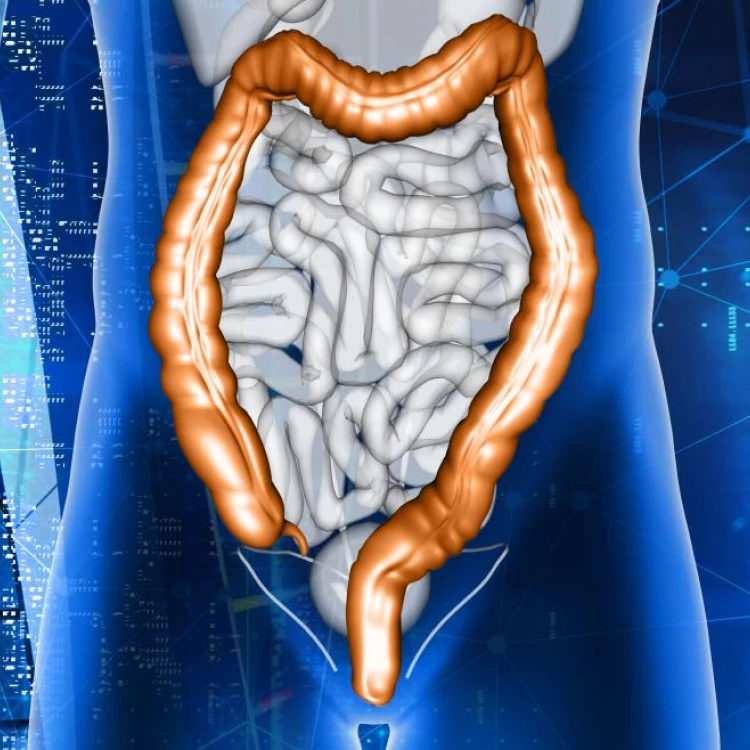 Imagen relacionada de reunion anual cirugia colorrectal madrid