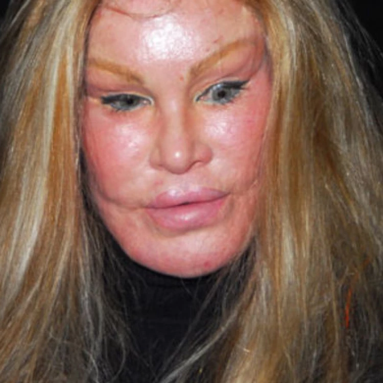 Imagen relacionada de fallece jocelyn wildenstein cirugia estetica