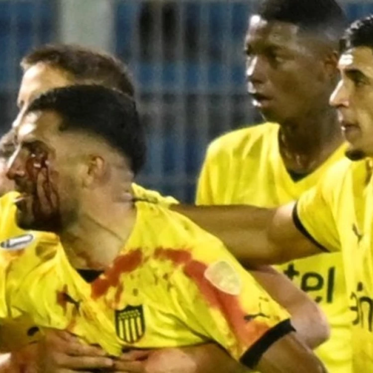 Imagen relacionada de escandalo en la copa libertadores rosario central triunfa pero genera polemica con agresion a jugador de penarol