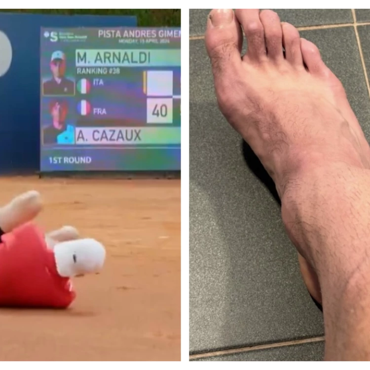 Imagen relacionada de lesion arthur cazaux atp barcelona